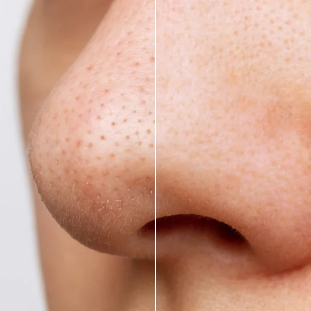 Loniage hoygi heartleaf pore control - óleo de limpeza facial coreano