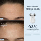 Loniage FaceSculpt