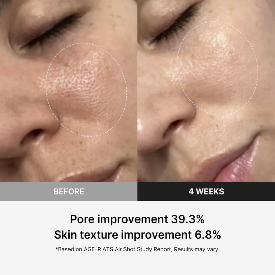 Loniage FaceLift Pro - Rejuvenescedor Facial Coreano com LED Terapia