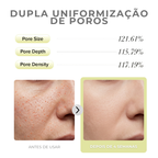 Loniage Dual Retinal Matrix-S