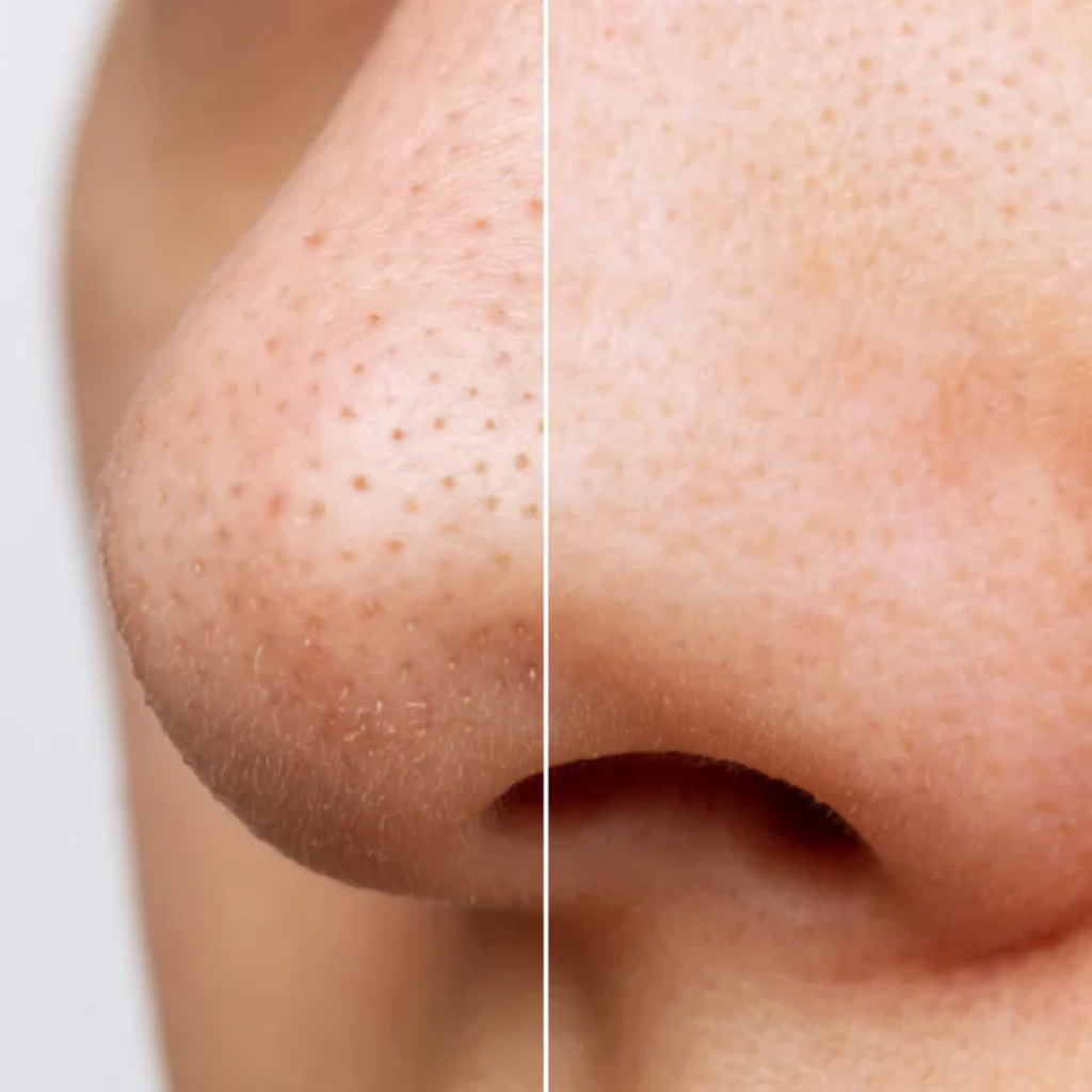 Heartleaf Duo de Limpeza Coreana - Cleansing Oil e Ampoule Foam