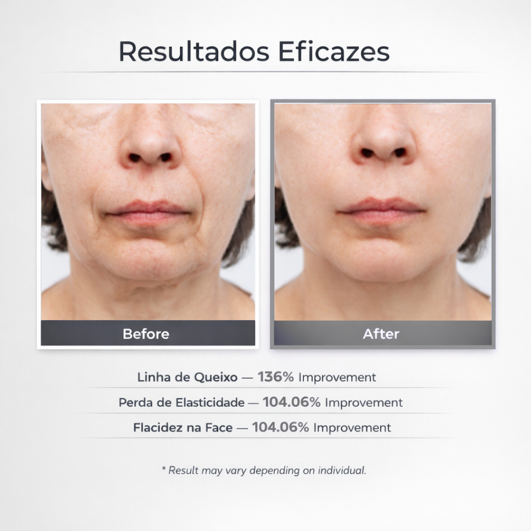 Loniage V-Shape™ Matrix Pro